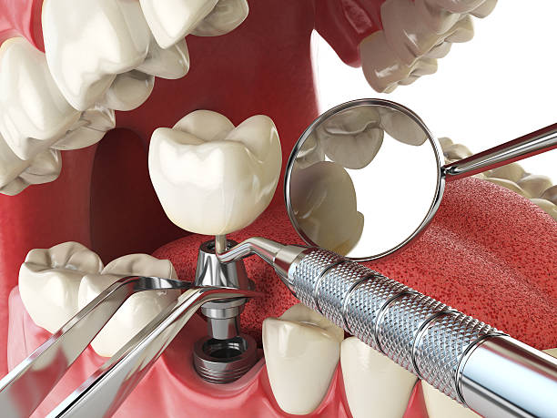 Best Weekend Emergency Dentist in Buttonwillow, CA